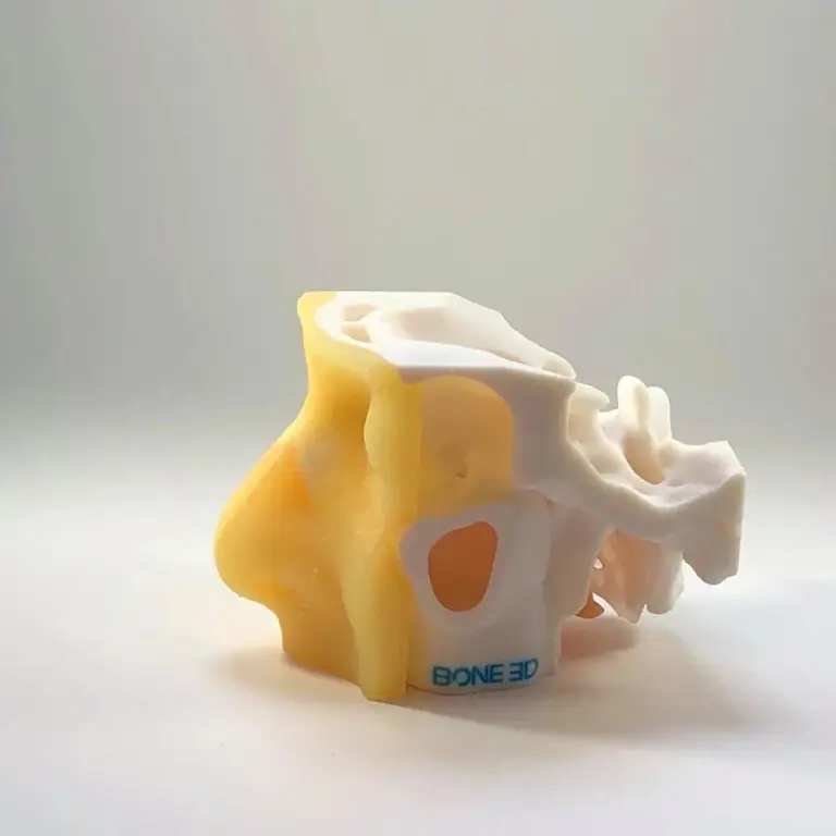 Un modèle anatomique imprimé en 3D représentant un crâne humain, mettant l'accent sur les cavités nasales et les sinus, présenté sur un fond blanc uni, constitue une excellente solution pédagogique et un simulateur nasopharyngé pour la formation du personnel médical.